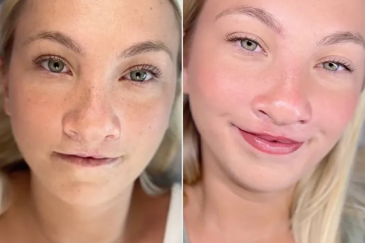 Woman-24-Underwent-20-Surgeries-For-Her-Cleft-Lip.-Then-This-Tattoo-Completely-Changed-Her-Appearance-Exclusive
