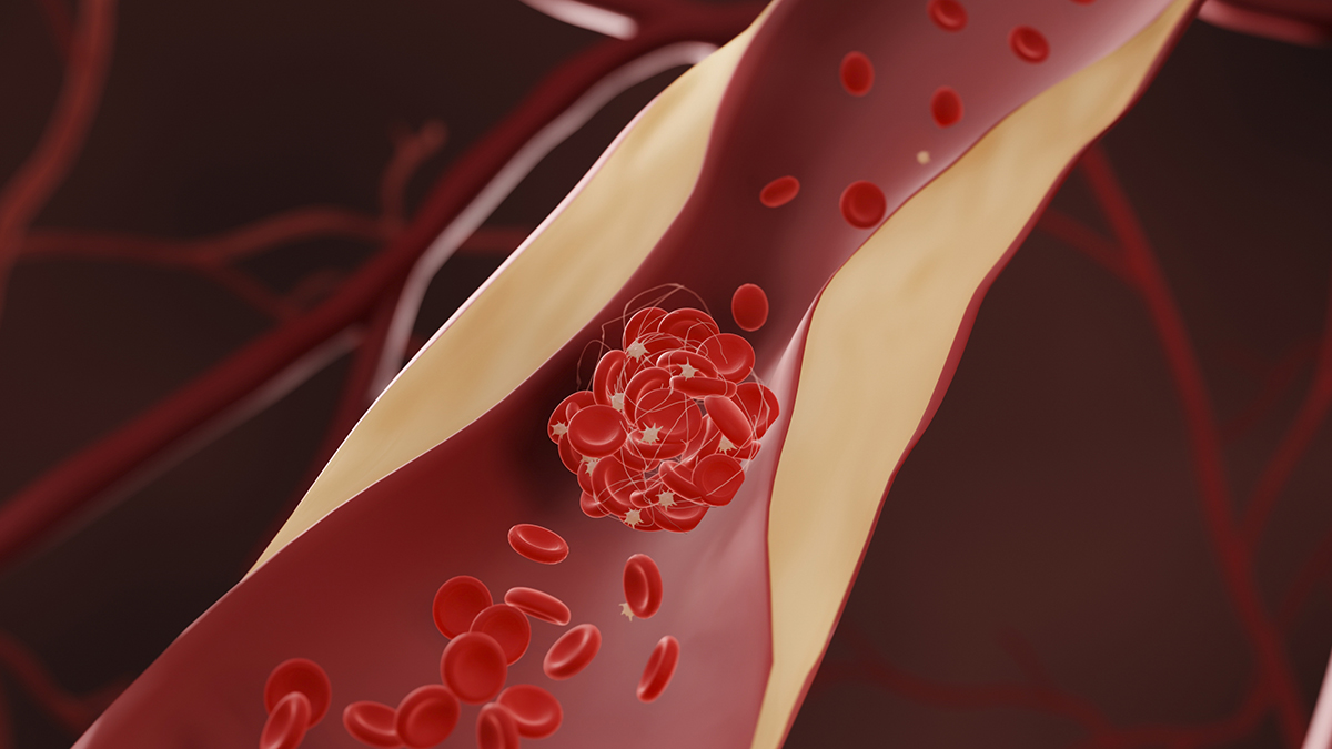 Drugs-That-Lower-Cholesterol-May-Also-Reduce-Dementia-Risk-Says-Huge-New-Study