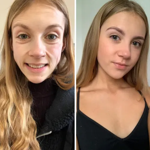 92-Stunning-Before-And-Afters-That-Prove-Anyone-Can-Completely-Reinvent-Themselves