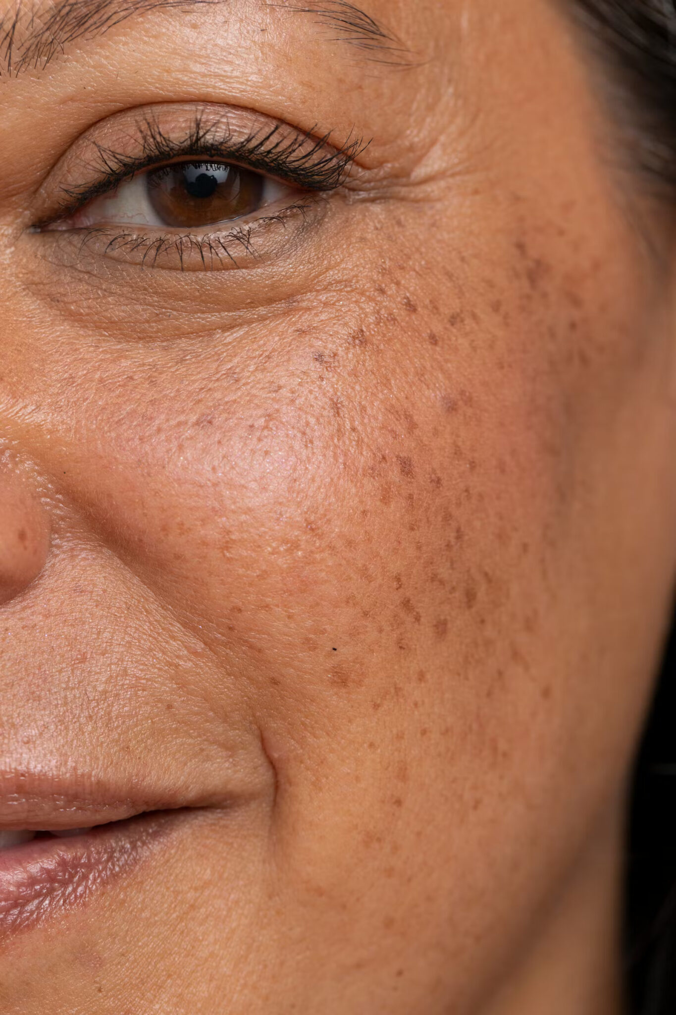 A-New-Controversial-Under-Eye-Treatment-Has-Entered-The-Chat