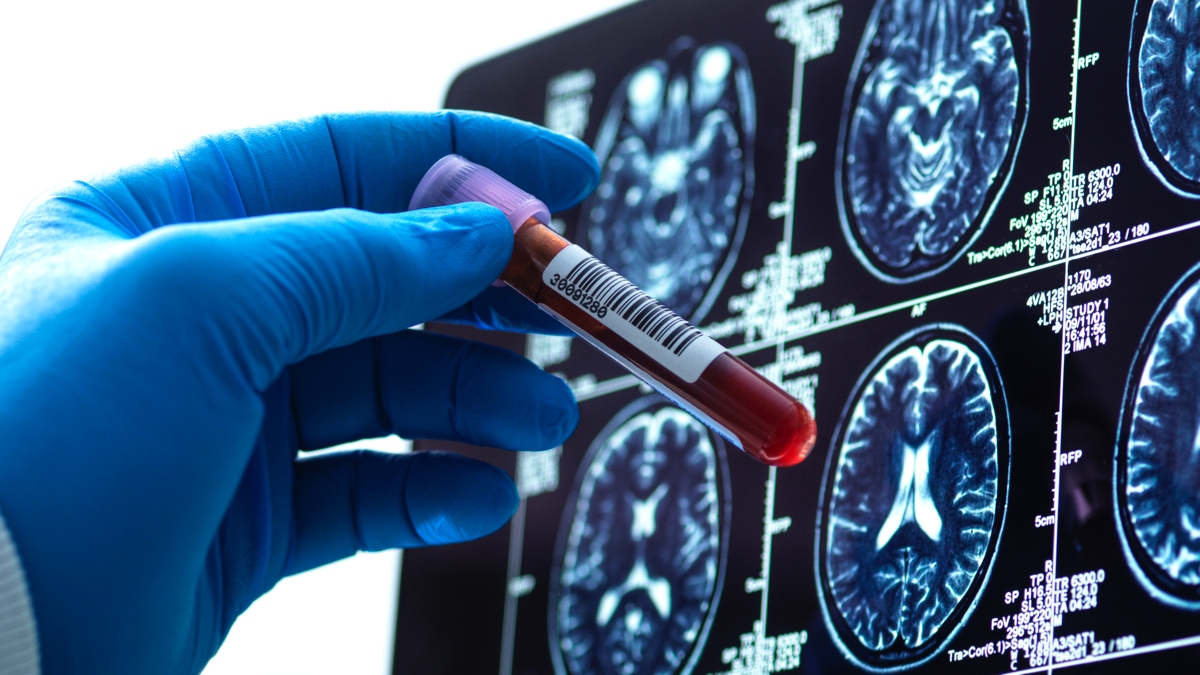 Super-Rare-Hybrid-Blood-Type-Discovered-in-Just-3-People