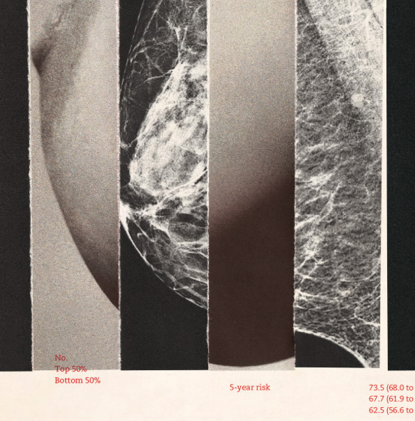 Whats-Your-Breast-Cancer-Risk-Really