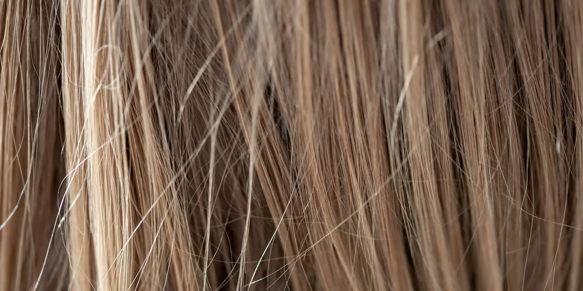 Heres-Everything-You-Need-To-Know-About-Using-Tretinoin-Cream-To-Treat-Hair-Loss-According-To-Experts